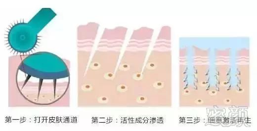 https://img.miyanlife.com/mnt/timg/171217/1253325F9-1.jpg