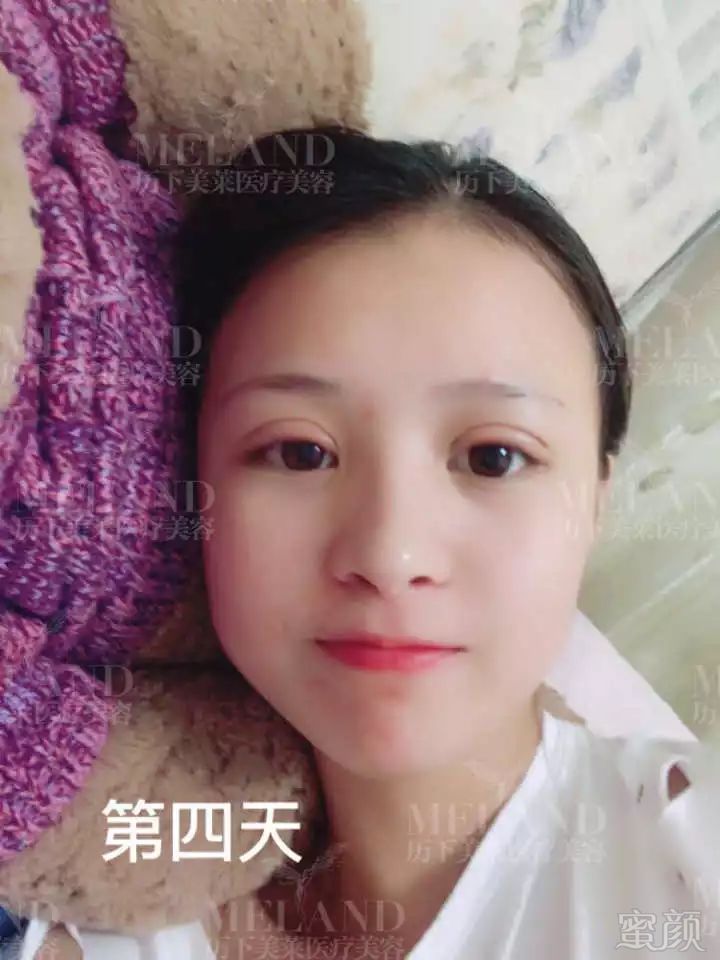 https://img.miyanlife.com/mnt/timg/171217/1301101E9-4.jpg
