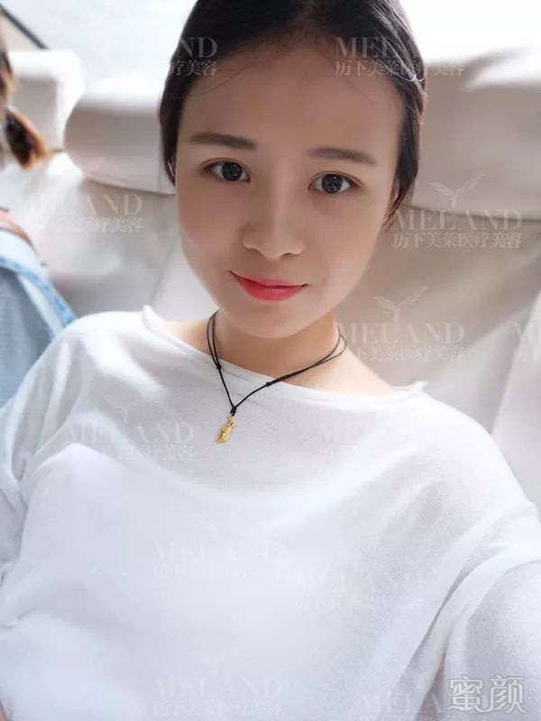 https://img.miyanlife.com/mnt/timg/171217/1301115143-5.jpg