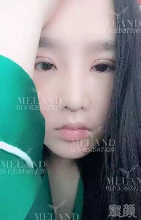 https://img.miyanlife.com/mnt/timg/171217/13011153P-7.jpg