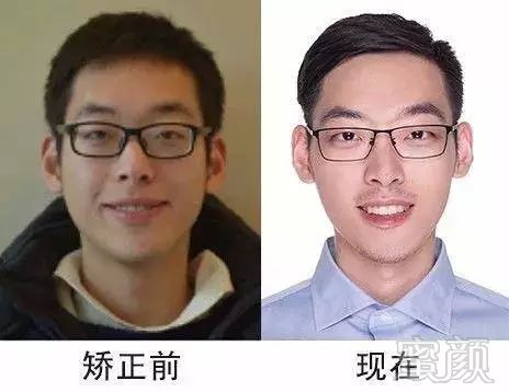 https://img.miyanlife.com/mnt/timg/171217/1309256107-11.jpg