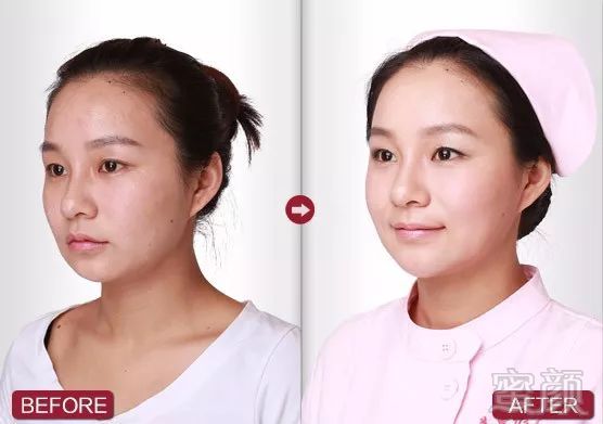 https://img.miyanlife.com/mnt/timg/171217/131SS539-0.jpg