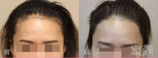 https://img.miyanlife.com/mnt/timg/171217/13205042R-10.jpg