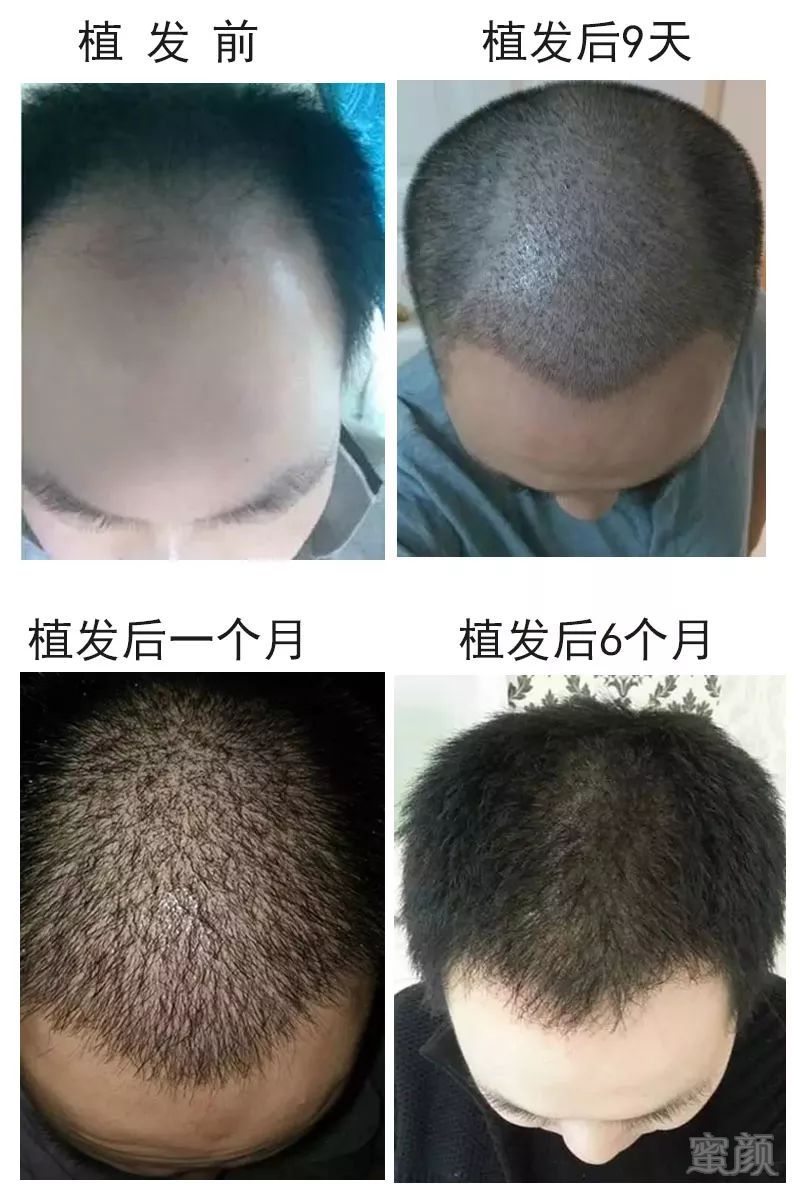 https://img.miyanlife.com/mnt/timg/171217/1320513H9-12.jpg