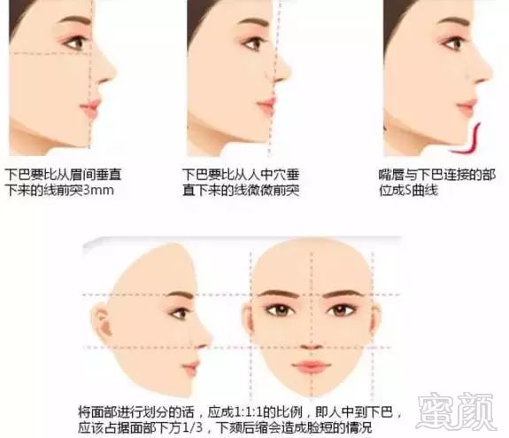 https://img.miyanlife.com/mnt/timg/171217/141154C93-7.jpg