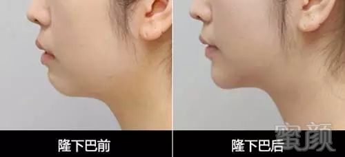 https://img.miyanlife.com/mnt/timg/171217/1411562Q6-14.jpg