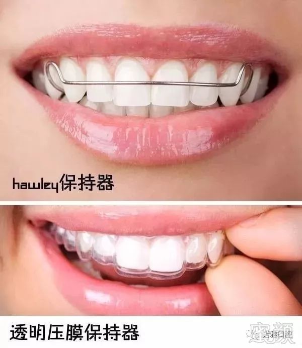 https://img.miyanlife.com/mnt/timg/171218/10253LA7-5.jpg