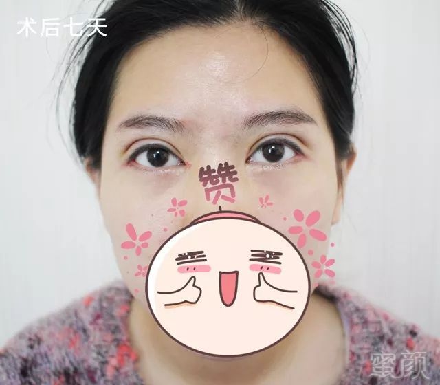 https://img.miyanlife.com/mnt/timg/171218/1030204B4-2.jpg
