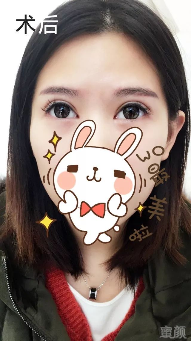 https://img.miyanlife.com/mnt/timg/171218/10302141Z-3.jpg
