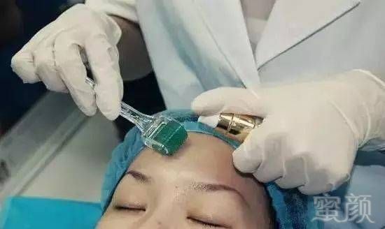 https://img.miyanlife.com/mnt/timg/171218/111G035H-9.jpg