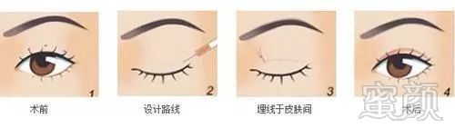 https://img.miyanlife.com/mnt/timg/171218/1124291S4-6.jpg
