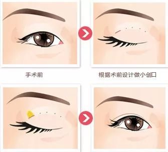 https://img.miyanlife.com/mnt/timg/171218/1124302160-7.jpg