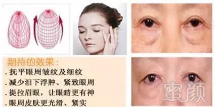 https://img.miyanlife.com/mnt/timg/171218/1215392041-11.jpg