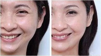 https://img.miyanlife.com/mnt/timg/171218/1215395596-7.jpg