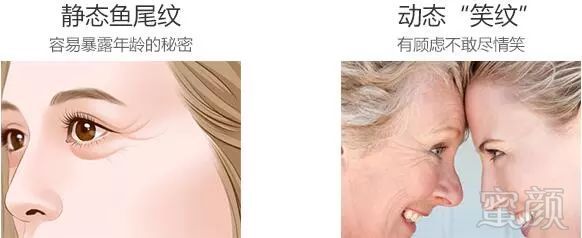 https://img.miyanlife.com/mnt/timg/171218/12153QQ8-5.jpg