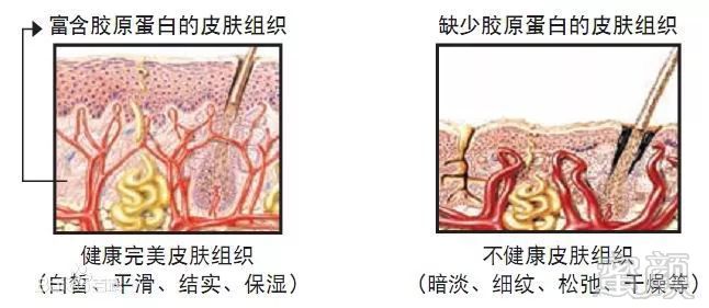 https://img.miyanlife.com/mnt/timg/171218/12153R435-4.jpg
