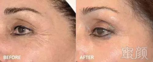 https://img.miyanlife.com/mnt/timg/171218/12153a952-9.jpg