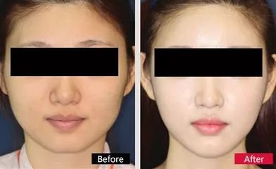 https://img.miyanlife.com/mnt/timg/171218/1300336343-1.jpg