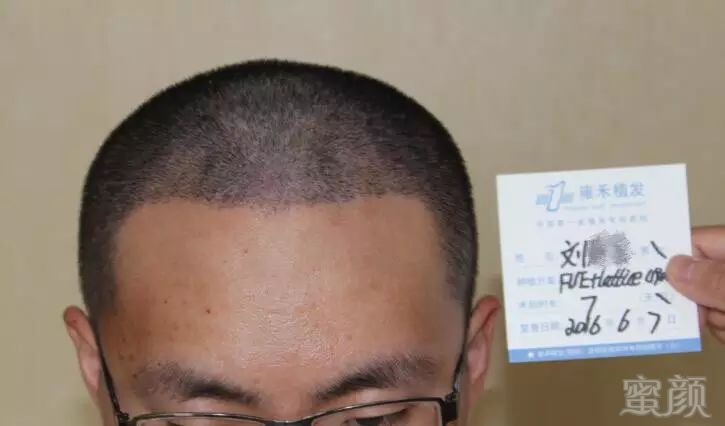 https://img.miyanlife.com/mnt/timg/171218/1303544M7-3.jpg