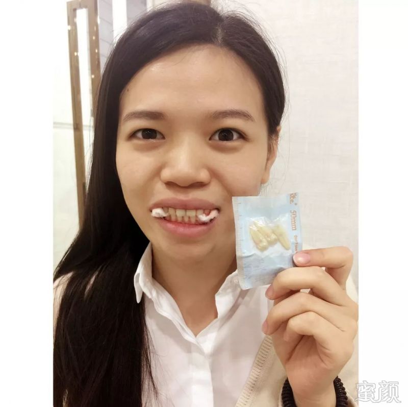 https://img.miyanlife.com/mnt/timg/171219/12031B433-4.jpg