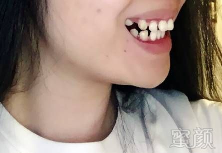 https://img.miyanlife.com/mnt/timg/171219/12031G641-9.jpg