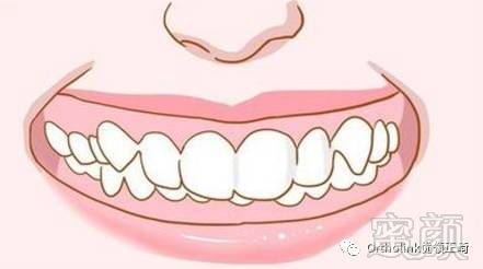 https://img.miyanlife.com/mnt/timg/171219/122150J03-1.jpg