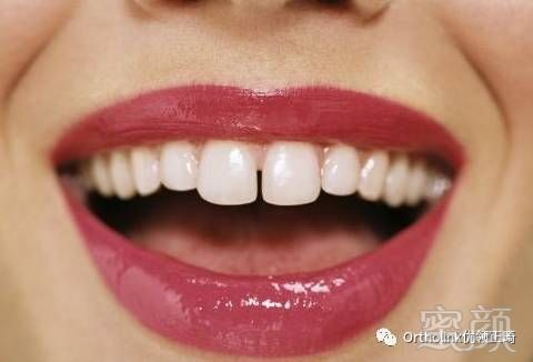 https://img.miyanlife.com/mnt/timg/171219/1221514M3-4.jpg