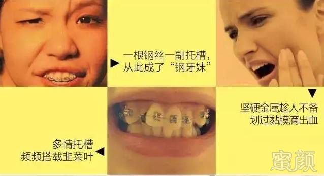 https://img.miyanlife.com/mnt/timg/171219/123T31O9-2.jpg