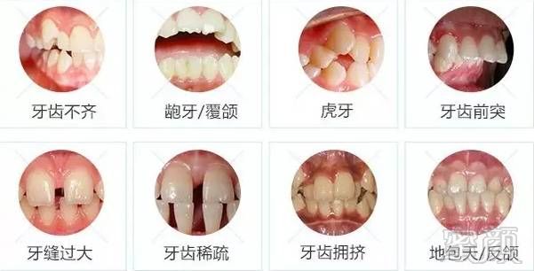 https://img.miyanlife.com/mnt/timg/171219/123T321L-1.jpg