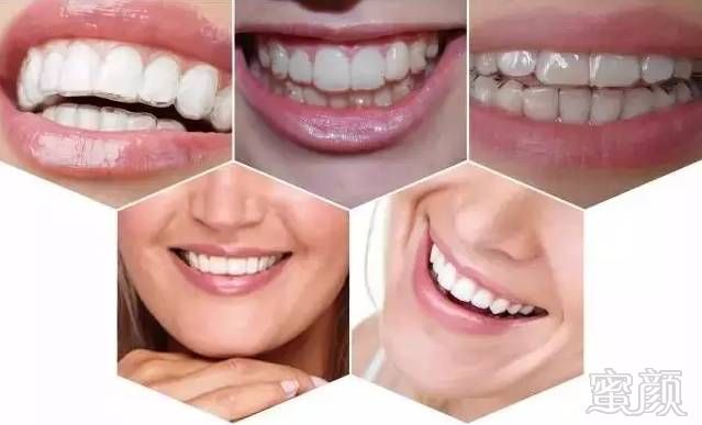 https://img.miyanlife.com/mnt/timg/171219/123T34220-4.jpg
