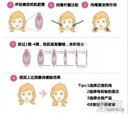 https://img.miyanlife.com/mnt/timg/171219/13152113T-3.jpg