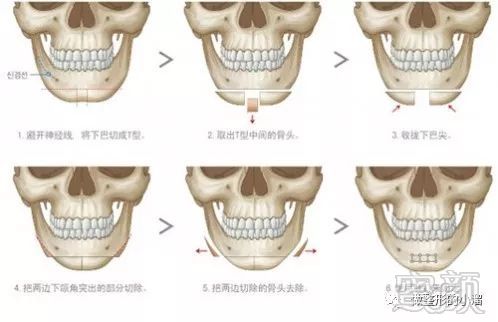 https://img.miyanlife.com/mnt/timg/171219/1315215438-2.jpg