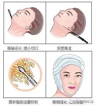 https://img.miyanlife.com/mnt/timg/171219/1315215P8-4.jpg