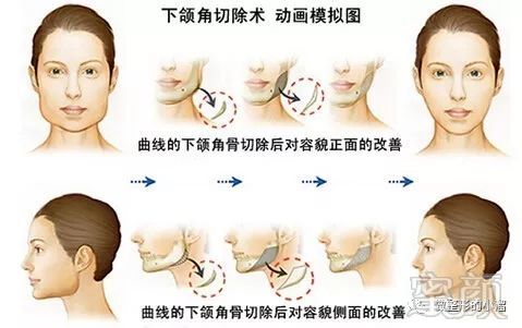 https://img.miyanlife.com/mnt/timg/171219/1315216317-0.jpg