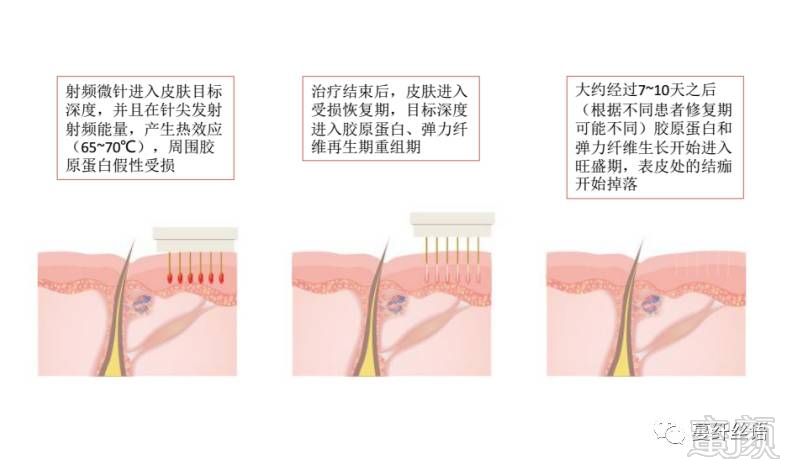 案例图片