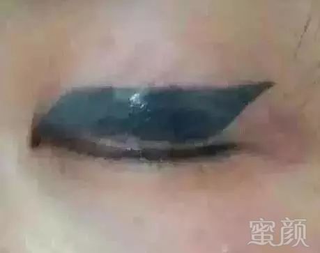 案例图片