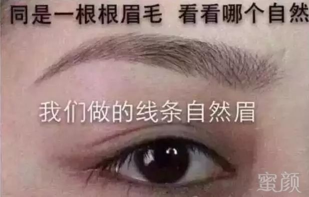 案例图片