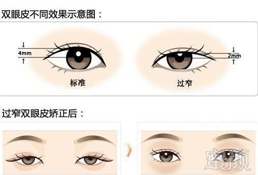 https://img.miyanlife.com/mnt/timg/171219/1400402040-2.jpg