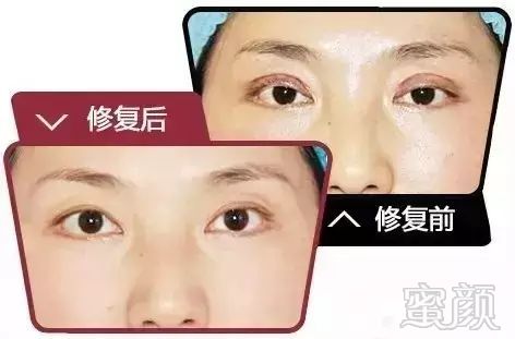 https://img.miyanlife.com/mnt/timg/171219/1400403045-3.jpg