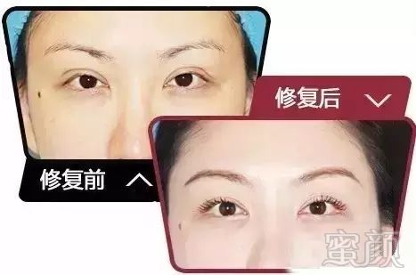 https://img.miyanlife.com/mnt/timg/171219/140042H00-4.jpg