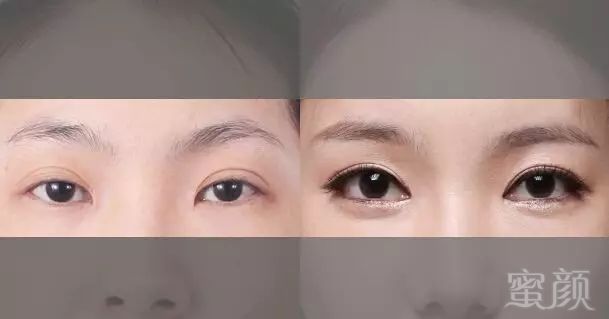 https://img.miyanlife.com/mnt/timg/171219/1404033048-0.jpg