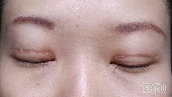 https://img.miyanlife.com/mnt/timg/171219/1404035N8-1.jpg