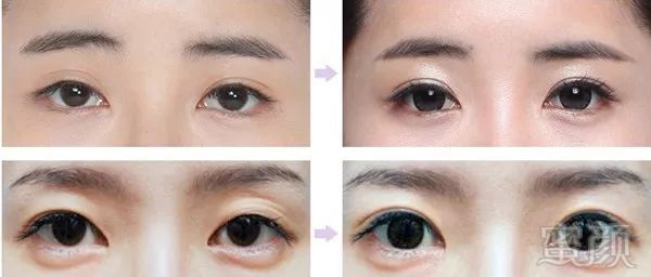 https://img.miyanlife.com/mnt/timg/171219/140404HW-5.jpg