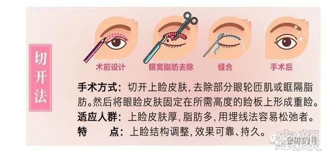 https://img.miyanlife.com/mnt/timg/171220/1439232006-0.jpg