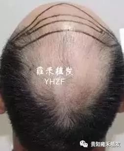 https://img.miyanlife.com/mnt/timg/171220/1501305J1-2.jpg