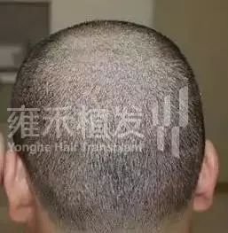 https://img.miyanlife.com/mnt/timg/171220/1501313513-3.jpg
