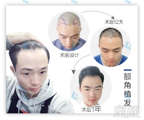 https://img.miyanlife.com/mnt/timg/171221/10460Gc6-7.jpg