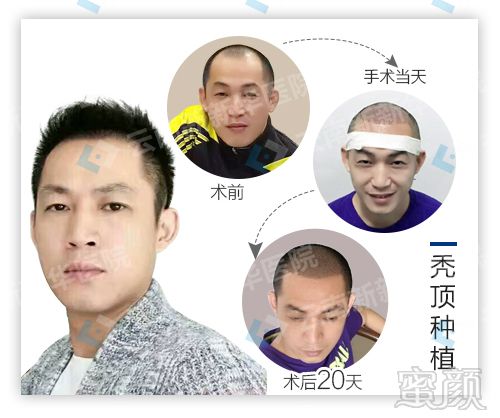 https://img.miyanlife.com/mnt/timg/171221/10460U520-8.jpg