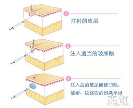 案例图片