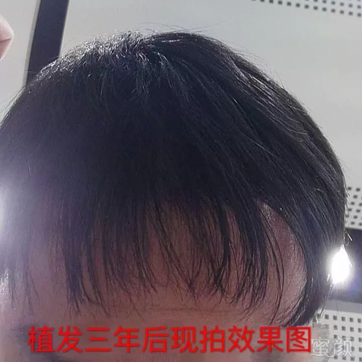 https://img.miyanlife.com/mnt/timg/171221/1050221411-2.jpg